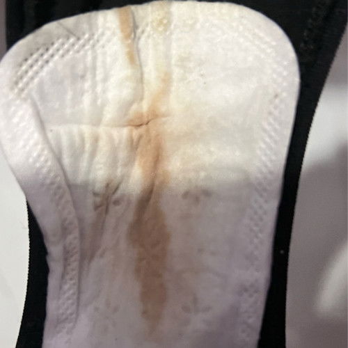 Spotting at 19weeks #worried