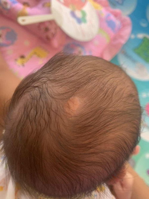 ที่หัวน้องมีรอย