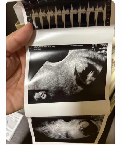 แม่ๆว่าผู้ชาย หรือผู้หญิงคะ