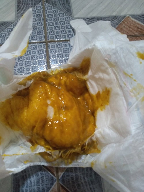 Fases bayi apa ini diare?
