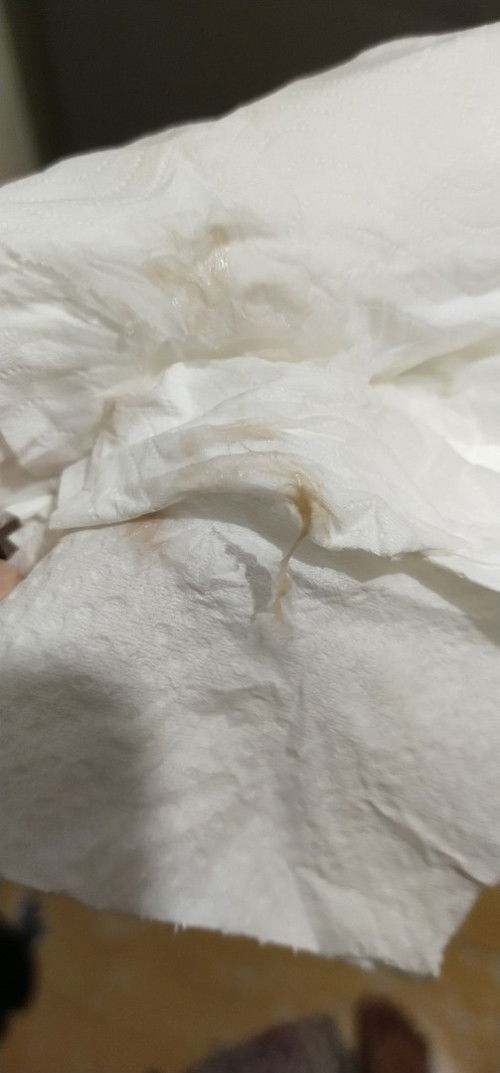 Light brown discharge