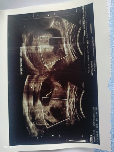 Uri banyak ruang kosong