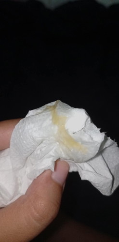 36W มีเมือกแบบนี้ไหล