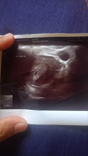 Normal tak kalau 6w mcm ni? Kne repeat scan lg 2w