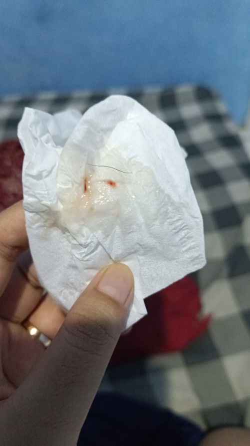 Bumil 7 minggu  ngeflek