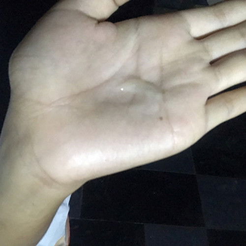 เป็นแบบนี้แล้วเจ็บท้องต้องไปหาหมอไหมคะ