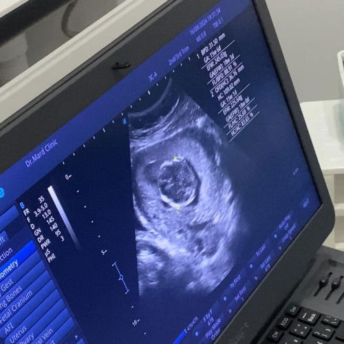 สงสัยแม่ๆช่วยตอบหน่อยน้าา