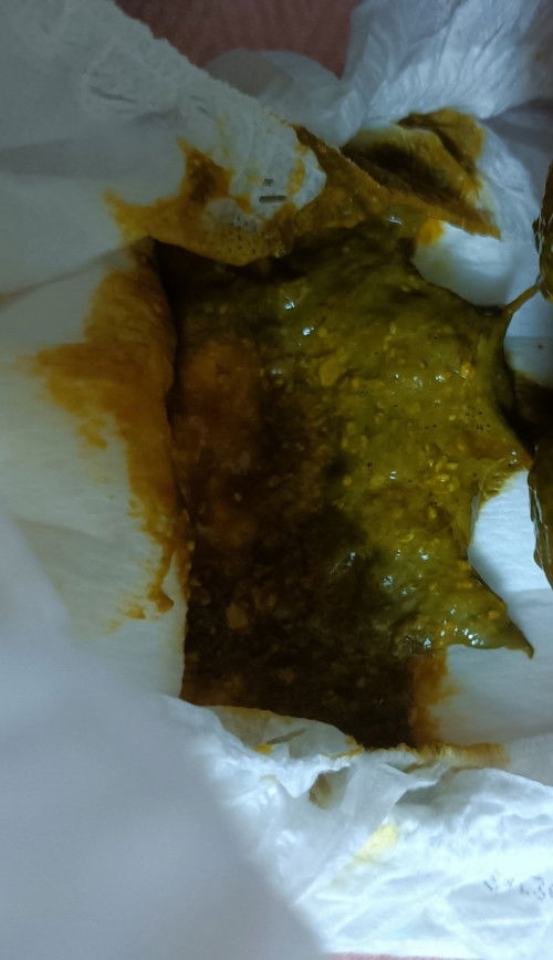 Normal ke najis mcm ni?