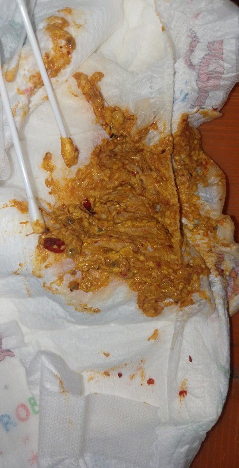 น้องกินนมชงตั้งแต่เกิดไม่เคยเป็นแบบนี้ค่ะ 1ปี3เดือน30วัน