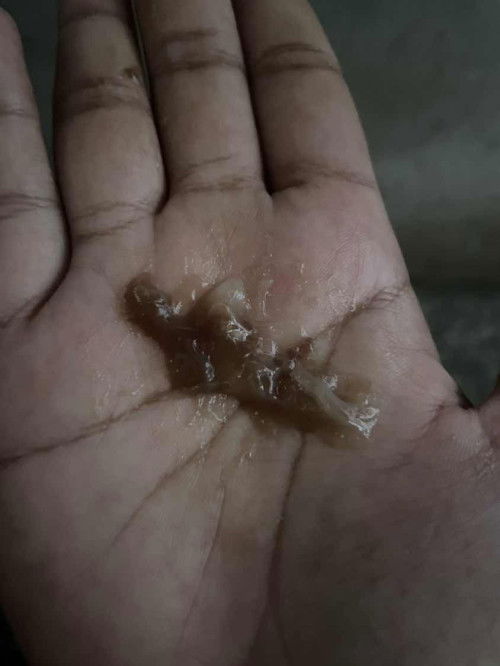 ใกล้คลอดยังคะ