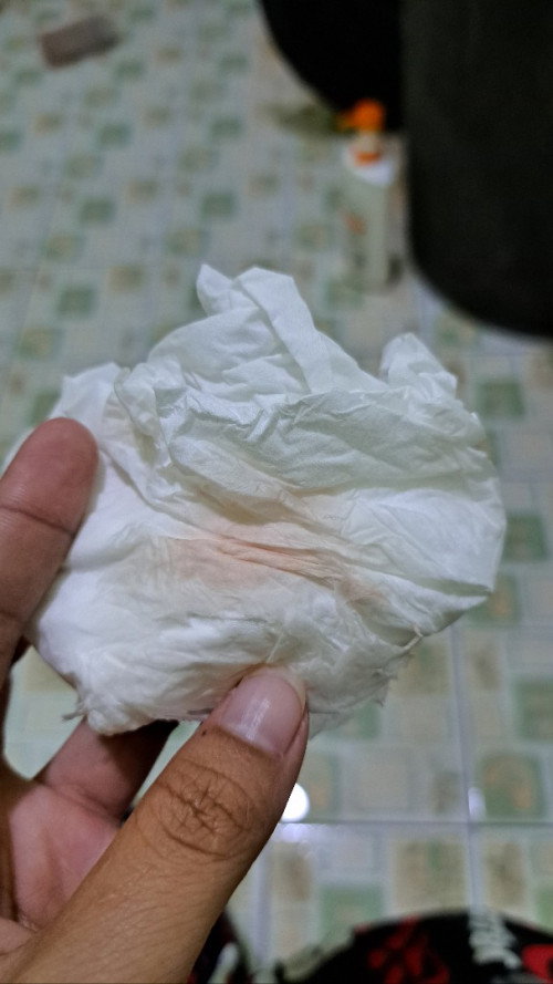 ปวดท้องน้อยข้างซ้าย