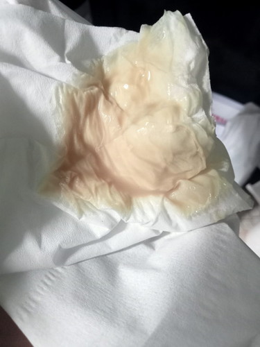 Pagi bund
Aku Lg hamil Minggu 6 knp ya suka ngflek coklat,n keram,kaki pegel ad yg ngrasain Kya aku