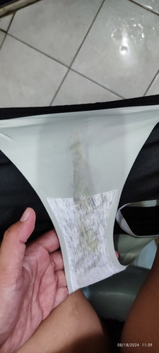 Normal po ba ito ? 37 weeks and 3 days na po ako. Medyo masakit po balakang. Parang tinutusok.