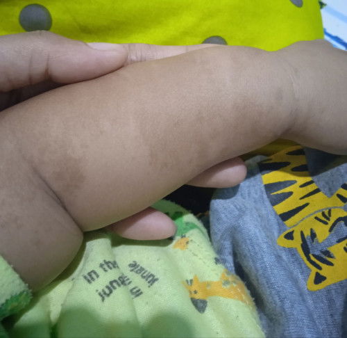 Warna kulit bayi tidak merata