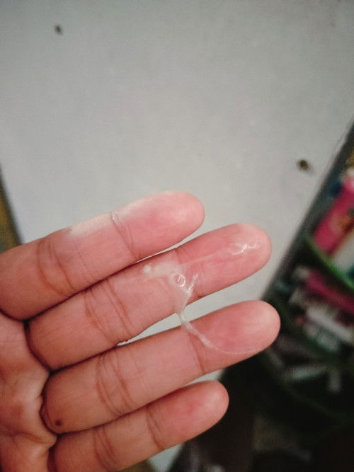 อาการ 37+1W  หมอนัดคลอด 7 กันยาบ้านอื่นเป็นเหมือนกันไหมค่ะ