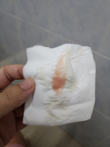 แบบนี้ต้องรีบไปหาหมอมั้ยคะ