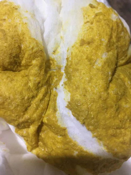 Mau tanya bun masalah bab bayi