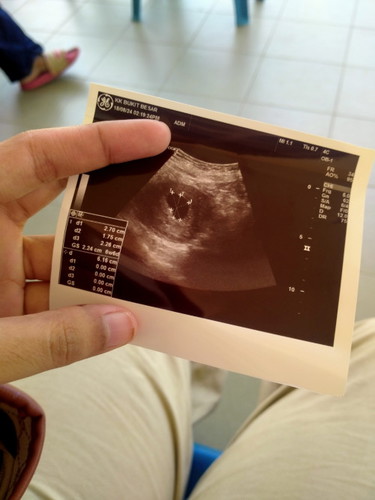 Sape yg penah mcm ni ?