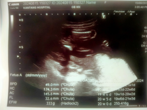 เเม่ช่วยดูเพศให้หน่อยนะค่ะ ซาวรพ.รัฐ หมอบอกไม่เห็นจู๋ เเต่ก้อไม่ได้บอกว่าผญ .100% แม่บ้านนี้ลุ้นมาก