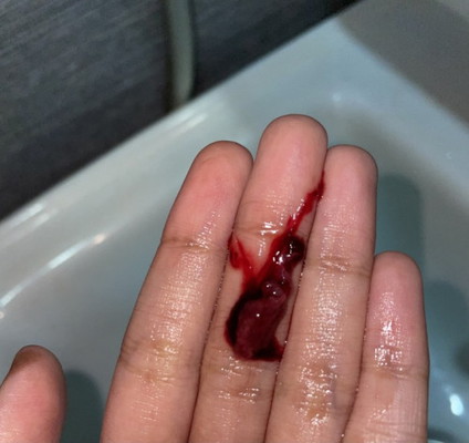 darah haid atau keguguran