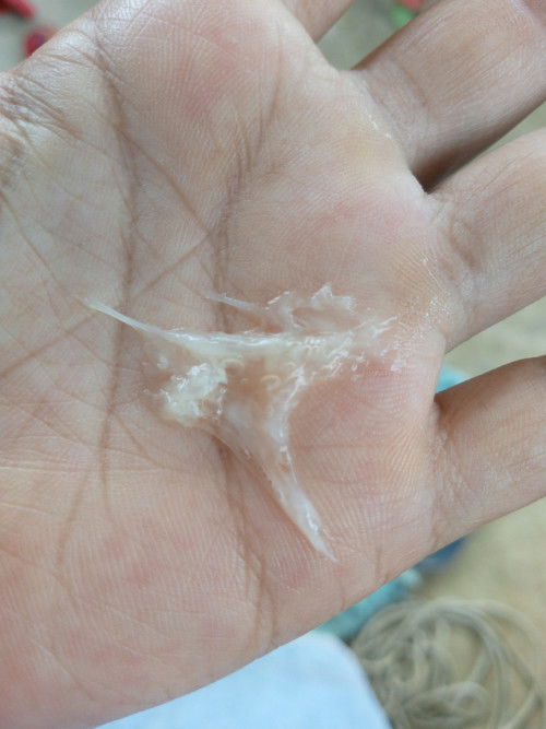 มูกใสหรทอมูกเลือด