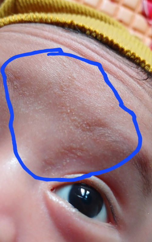 Ad gk punya bayu kulitnya seperti itu