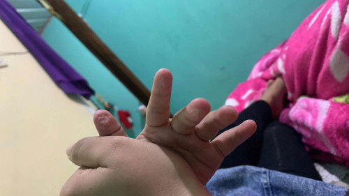 Tangan anak keriput pas bangun tidur