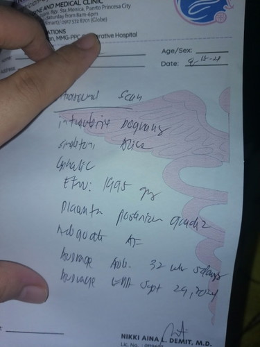 Normal po ba yung sa ultrasound ko?