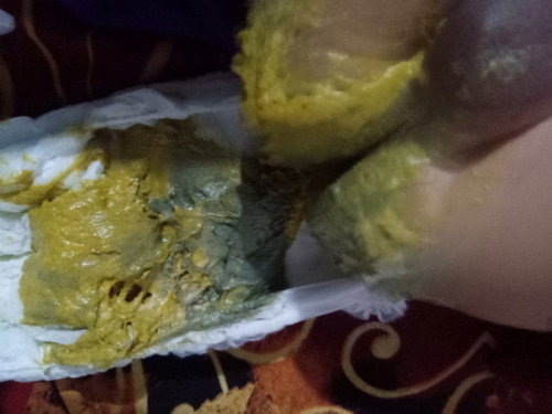 Pup bayi warnanya ada abu"nya