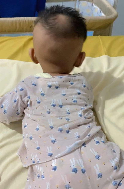bentuk kepala bayi 3 bulan