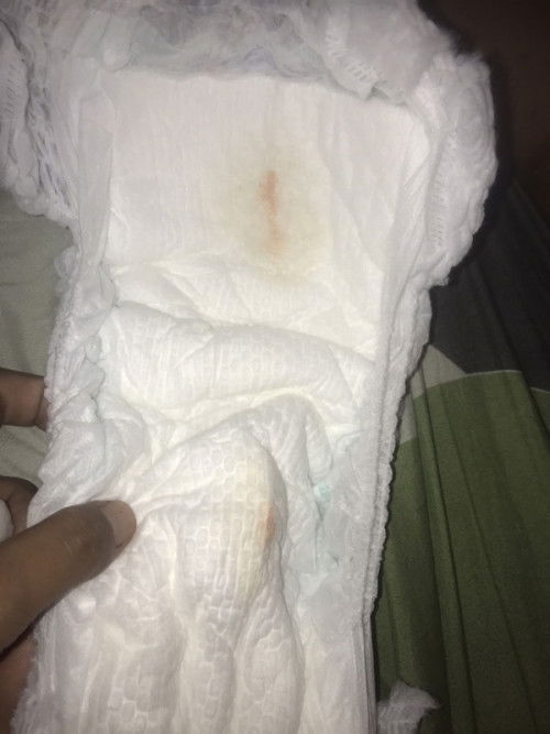 Bercak darah di diapers