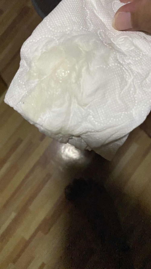 มูกขาวข้ร ตอน 8 เดือน