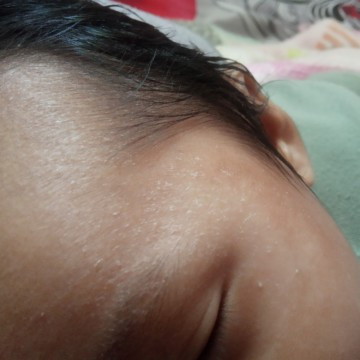 Mau nanya bunda² hebad,ini kulit bayi saya kering atau dia gag cocok sama sabunnya,bayi umur 2bulan