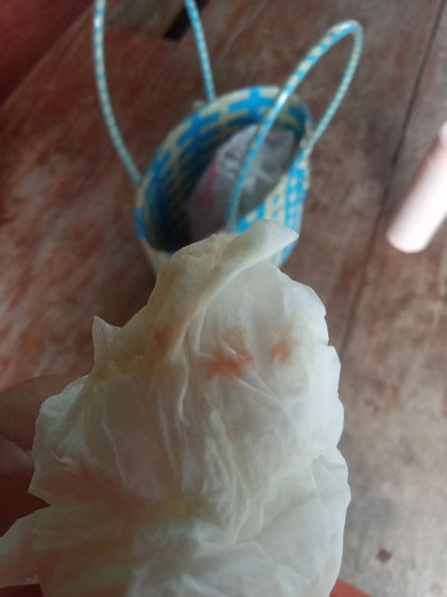 มีเลือดออก36วีค2วันแต่ไม่เจ็บท้อง