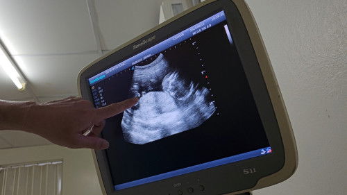 ช่วยดูหน่อยค่า ช หรือ ญ คะ 
17weeksค่ะ