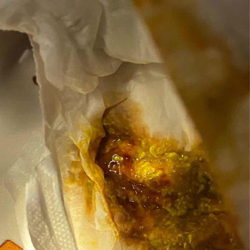 ปกติมั้ยคะแบบนึ้มีเลือดปนออกมา