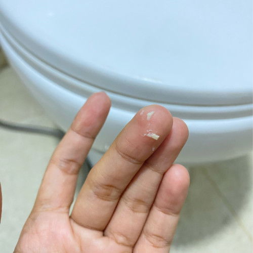 Keputihan normal atau tidak normal