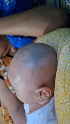 Kepala ijo ijo