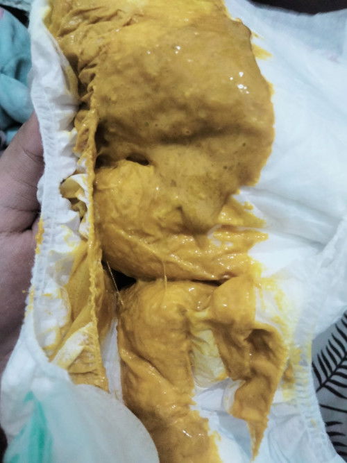 Pup bayi kuning berlendir