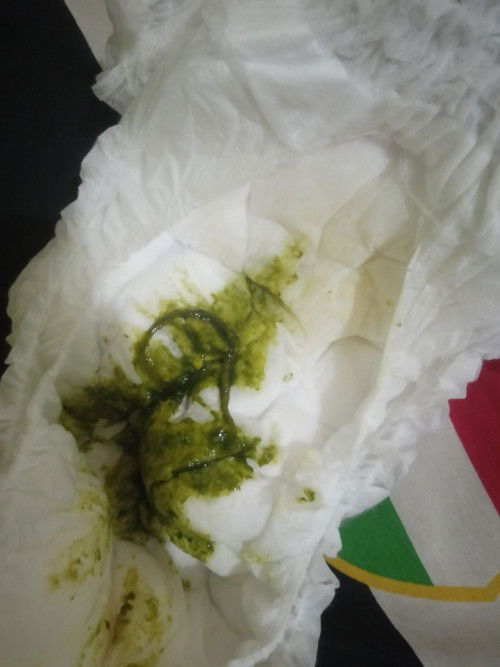 Bab cair berlendir dan berwarna hijau