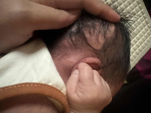 Benjolan di belakang telinga