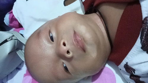 Bunda bunda ada yang pernah anaknya Kya anakku ngga dagunya??