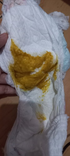 BAB Bayi berlendir