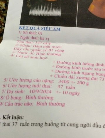 NÊN MỔ CHỦ ĐỘNG HAY SINH THƯỜNG