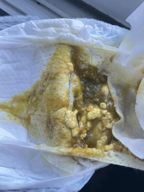 อึแบบนี้ปกติไหมคะ ?