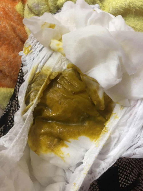 ถ่ายปกติไหมคะ