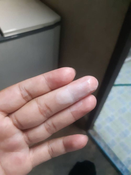 กังวลมากเลยค่ะ