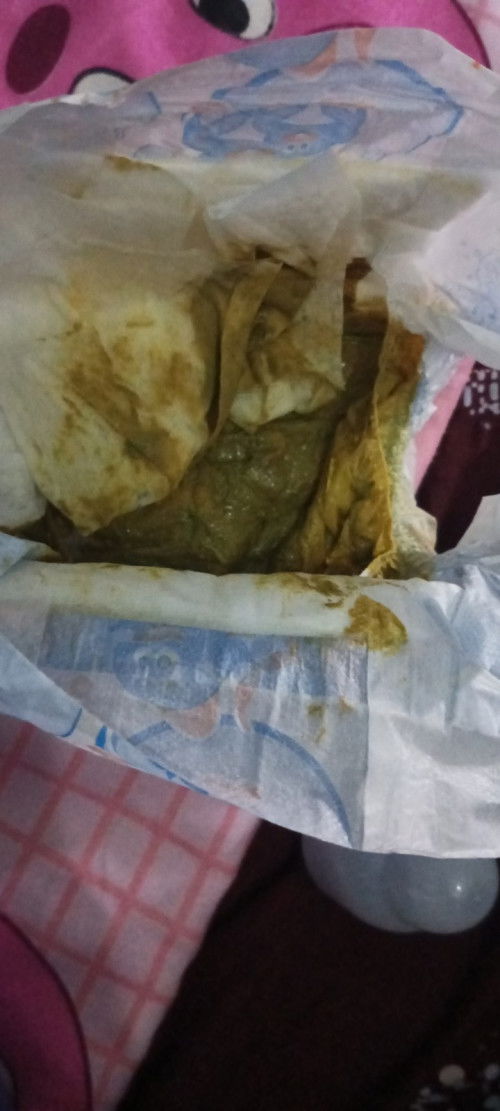 tanong lng po I'm 1st time mom, normal lng ba na ganito poops ni baby? 21 days na sya