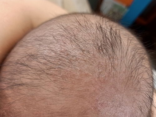 Seputar kepala bayi usia 2 bulan