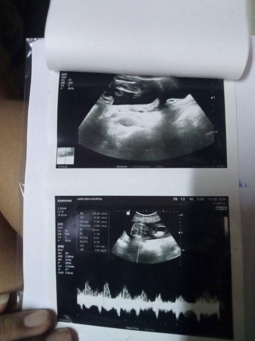 แม่ๆๆช่วยดูหน่อยค่ะ